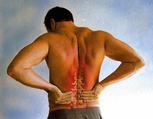 Как правильно выбрать лучшую мазь от боли в спине