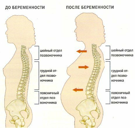 8 причин, которые провоцируют боли в спине у беременных
